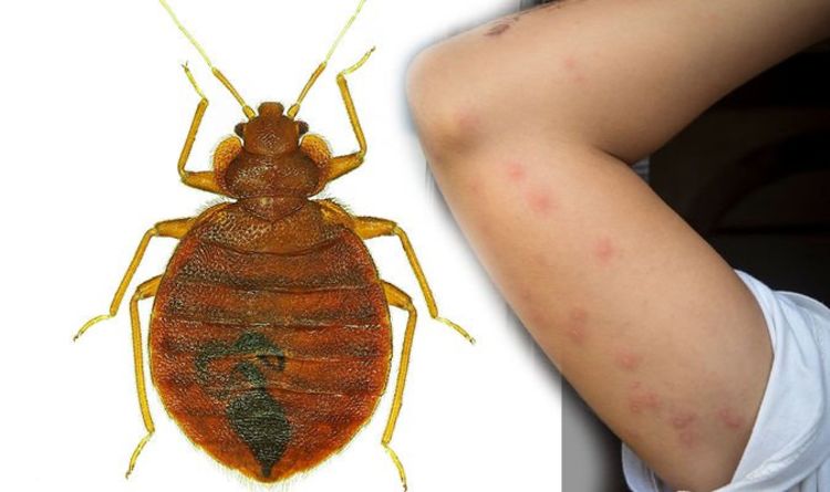 What are the Ways by which Bed Bugs can Impact Your Health?