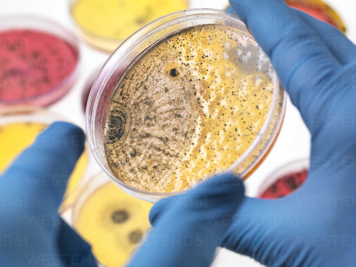 Guide to The Importance of Measuring Bacteria in Your Environment